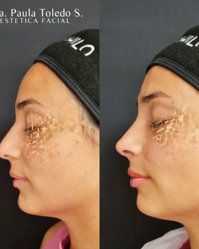 Caso de éxito: resultado de armónico de labios